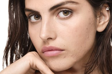 Skincare-Vichy-macchiedabrufoli-ottimizzazione-revisionato