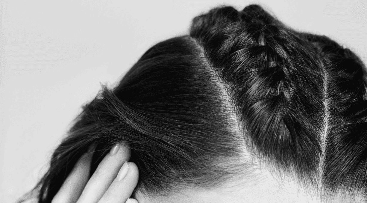 foto del cuoio capelluto con treccia