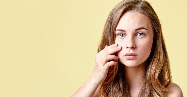 Giovane donna con pelle a tendenza acneica