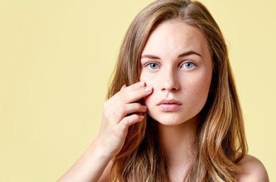 Giovane donna con pelle a tendenza acneica