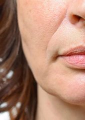 primo piano della parte inferiore del viso di una donna