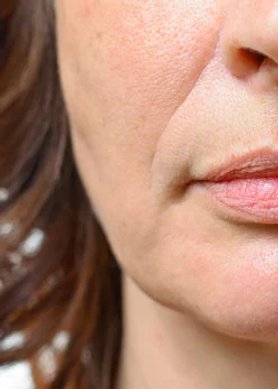 primo piano della parte inferiore del viso di una donna