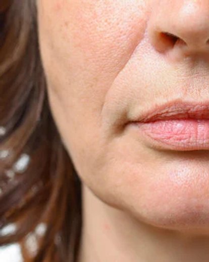 primo piano della parte inferiore del viso di una donna