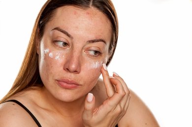 Skincare-Vichy-macchieormonali-nuovoarticolo