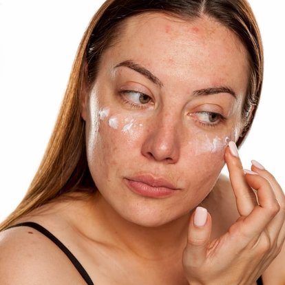 Skincare-Vichy-macchieormonali-nuovoarticolo