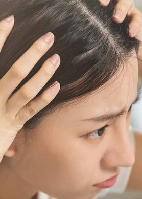 primo piano di una donna che esamina il suo cuoio capelluto