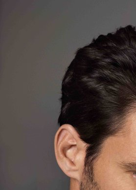 fasi della caduta dei capelli come agire in fretta