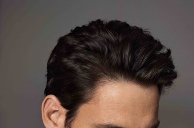 fasi della caduta dei capelli come agire in fretta