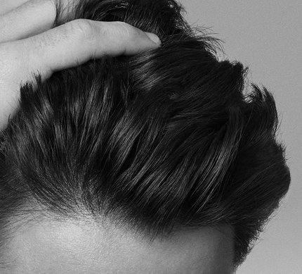 hairloss