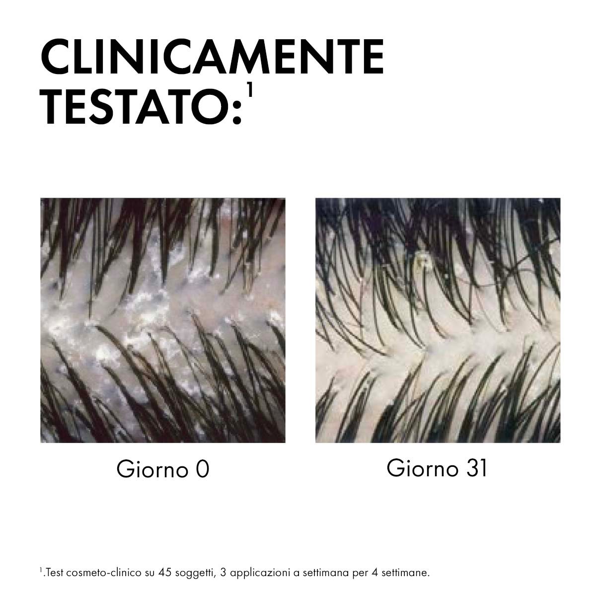 efficacia shampoo dercos 400 ml